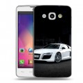 Дизайнерский пластиковый чехол для LG L60 Audi