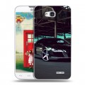 Дизайнерский пластиковый чехол для LG L80 Audi