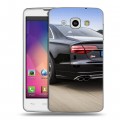 Дизайнерский пластиковый чехол для LG L60 Audi