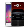 Дизайнерский пластиковый чехол для LG L60 Audi