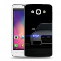 Дизайнерский пластиковый чехол для LG L60 Audi