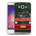 Дизайнерский пластиковый чехол для LG L60 BMW