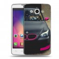 Дизайнерский пластиковый чехол для LG L60 BMW