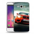 Дизайнерский пластиковый чехол для LG L60 BMW