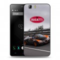 Дизайнерский силиконовый чехол для Doogee X5 Bugatti