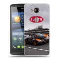 Дизайнерский пластиковый чехол для Acer Liquid E3 Bugatti