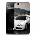 Дизайнерский силиконовый чехол для Doogee X5 Bugatti