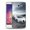 Дизайнерский пластиковый чехол для LG L60 Bugatti