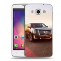 Дизайнерский пластиковый чехол для LG L60 Cadillac