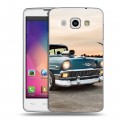 Дизайнерский пластиковый чехол для LG L60 Chevrolet