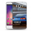 Дизайнерский пластиковый чехол для LG L60 Chevrolet