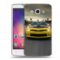 Дизайнерский пластиковый чехол для LG L60 Chevrolet