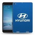 Дизайнерский силиконовый чехол для Xiaomi Mi Pad 2 Hyundai