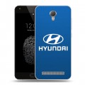 Дизайнерский пластиковый чехол для Umi Touch Hyundai