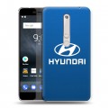 Дизайнерский пластиковый чехол для Nokia 6 (2018) Hyundai