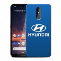 Дизайнерский силиконовый чехол для Nokia 3.2 Hyundai