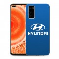 Дизайнерский силиконовый чехол для Huawei Honor View 30 Pro Hyundai