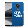 Дизайнерский силиконовый чехол для Nokia 3.4 Hyundai