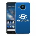 Дизайнерский силиконовый чехол для Nokia 8.3 Hyundai