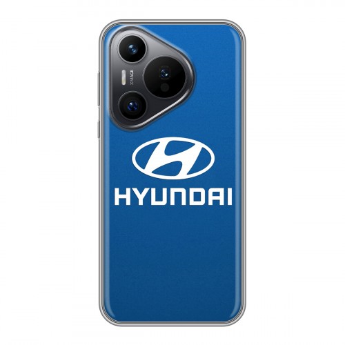 Дизайнерский силиконовый чехол для Huawei Pura 70 Hyundai