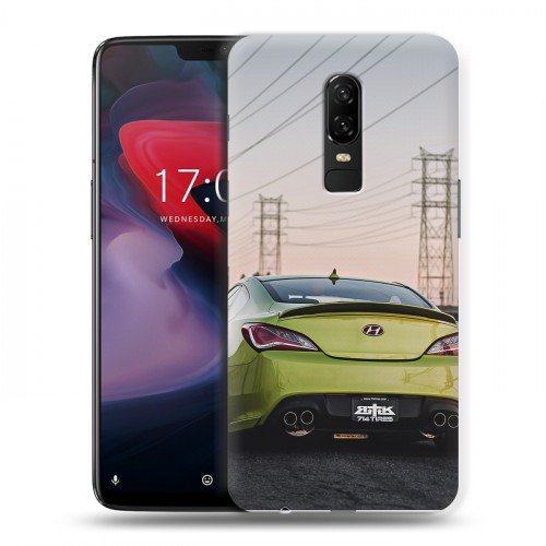 Дизайнерский пластиковый чехол для OnePlus 6 Hyundai