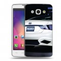 Дизайнерский пластиковый чехол для LG L60 Hyundai