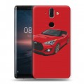 Дизайнерский пластиковый чехол для Nokia 8 Sirocco Hyundai