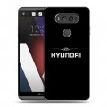 Дизайнерский пластиковый чехол для LG V20 Hyundai