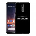 Дизайнерский силиконовый чехол для Nokia 3.2 Hyundai