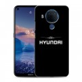 Дизайнерский силиконовый чехол для Nokia 5.4 Hyundai