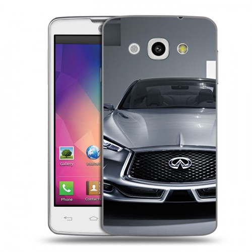 Дизайнерский пластиковый чехол для LG L60 Infiniti