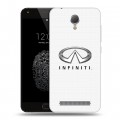 Дизайнерский пластиковый чехол для Umi Touch Infiniti