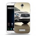 Дизайнерский пластиковый чехол для Doogee X6 Infiniti