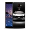 Дизайнерский пластиковый чехол для Nokia 7 Plus Infiniti