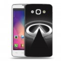 Дизайнерский пластиковый чехол для LG L60 Infiniti