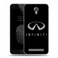 Дизайнерский пластиковый чехол для Umi Touch Infiniti