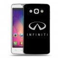 Дизайнерский пластиковый чехол для LG L60 Infiniti