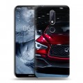 Дизайнерский пластиковый чехол для Nokia 6.1 Plus Infiniti