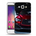 Дизайнерский пластиковый чехол для LG L60 Infiniti