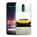 Дизайнерский силиконовый чехол для Nokia 3.2 McLaren