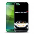 Дизайнерский силиконовый чехол для Elephone S7 McLaren