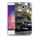 Дизайнерский пластиковый чехол для LG L60 Mercedes