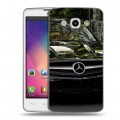 Дизайнерский пластиковый чехол для LG L60 Mercedes