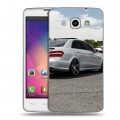 Дизайнерский пластиковый чехол для LG L60 Mercedes