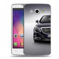 Дизайнерский пластиковый чехол для LG L60 Mercedes