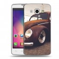 Дизайнерский пластиковый чехол для LG L60 Volkswagen