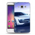 Дизайнерский пластиковый чехол для LG L60 Volkswagen