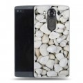 Дизайнерский пластиковый чехол для LG V10 Текстура камня