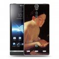 Дизайнерский пластиковый чехол для Sony Xperia S