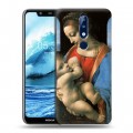 Дизайнерский силиконовый чехол для Nokia 5.1 Plus